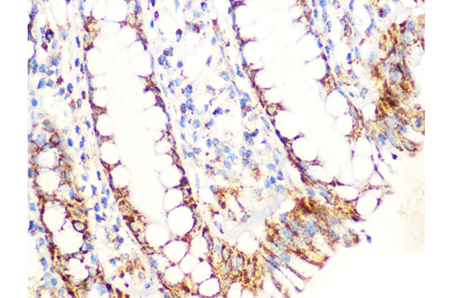 Immunohistochemistry - Anti-Aconitase 2 Antibody [ARC1072] (A306968) - Antibodies.com