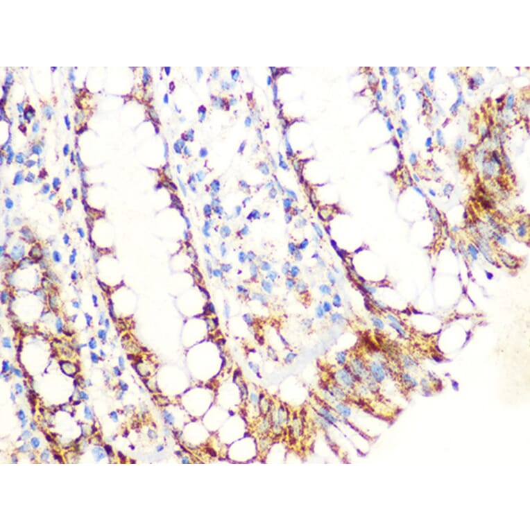 Immunohistochemistry - Anti-Aconitase 2 Antibody [ARC1072] (A306968) - Antibodies.com