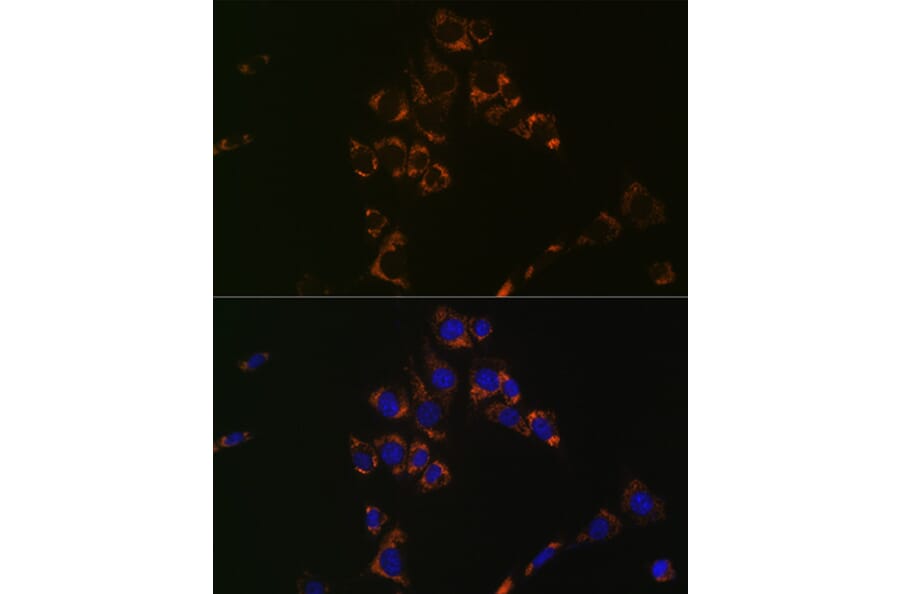 Immunofluorescence - Anti-Aconitase 2 Antibody [ARC1072] (A306968) - Antibodies.com