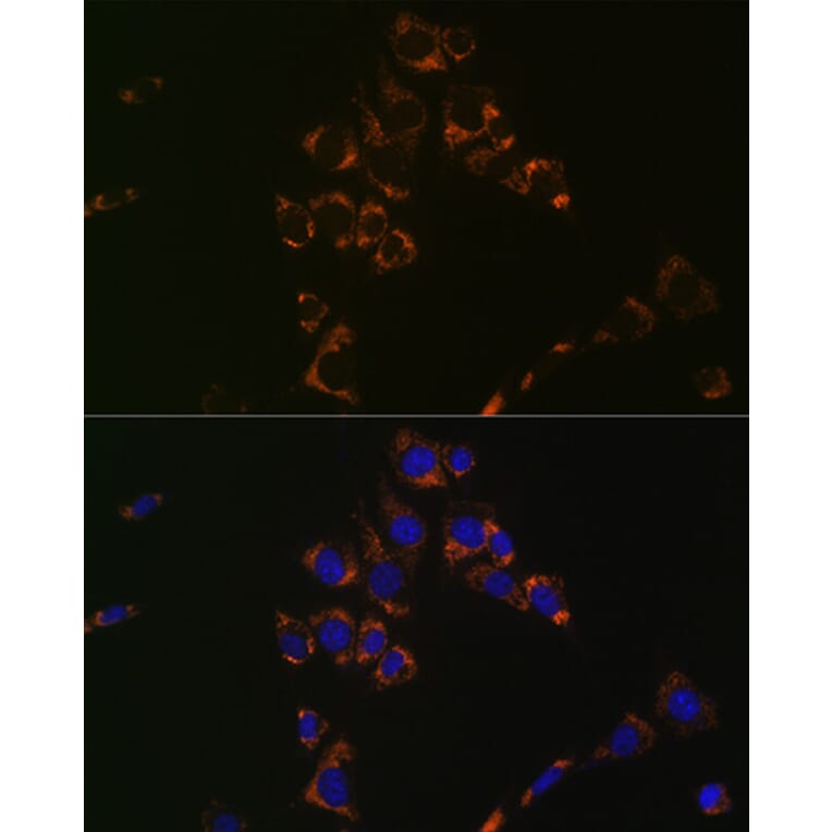 Immunofluorescence - Anti-Aconitase 2 Antibody [ARC1072] (A306968) - Antibodies.com