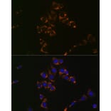 Immunofluorescence - Anti-Aconitase 2 Antibody [ARC1072] (A306968) - Antibodies.com