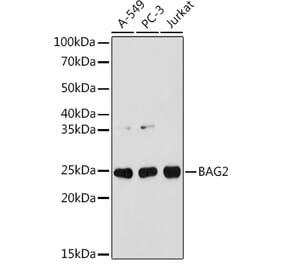Western Blot - Anti-BAG2 Antibody [ARC1297] (A306969) - Antibodies.com
