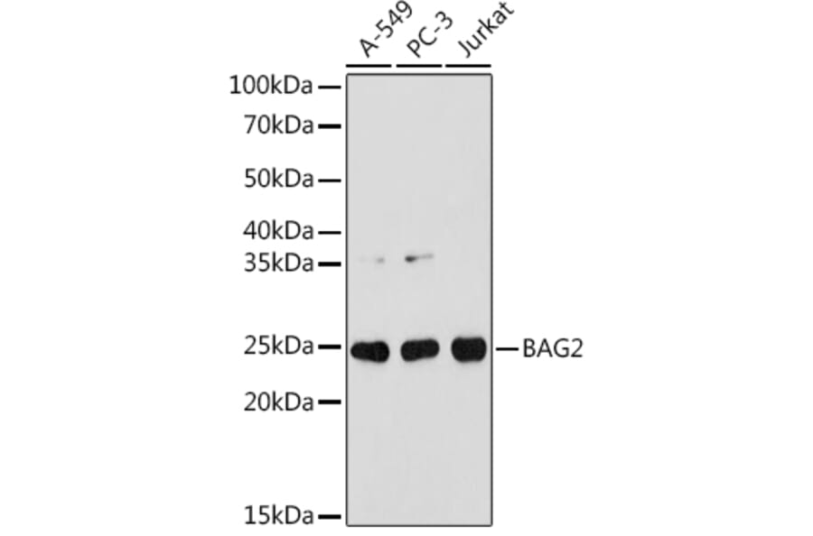 Western Blot - Anti-BAG2 Antibody [ARC1297] (A306969) - Antibodies.com