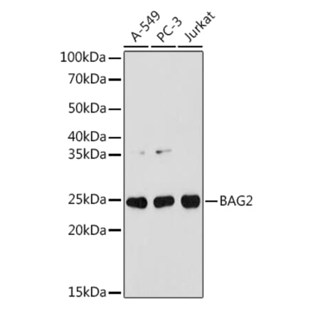 Western Blot - Anti-BAG2 Antibody [ARC1297] (A306969) - Antibodies.com