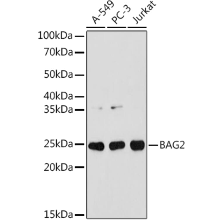 Western Blot - Anti-BAG2 Antibody [ARC1297] (A306969) - Antibodies.com