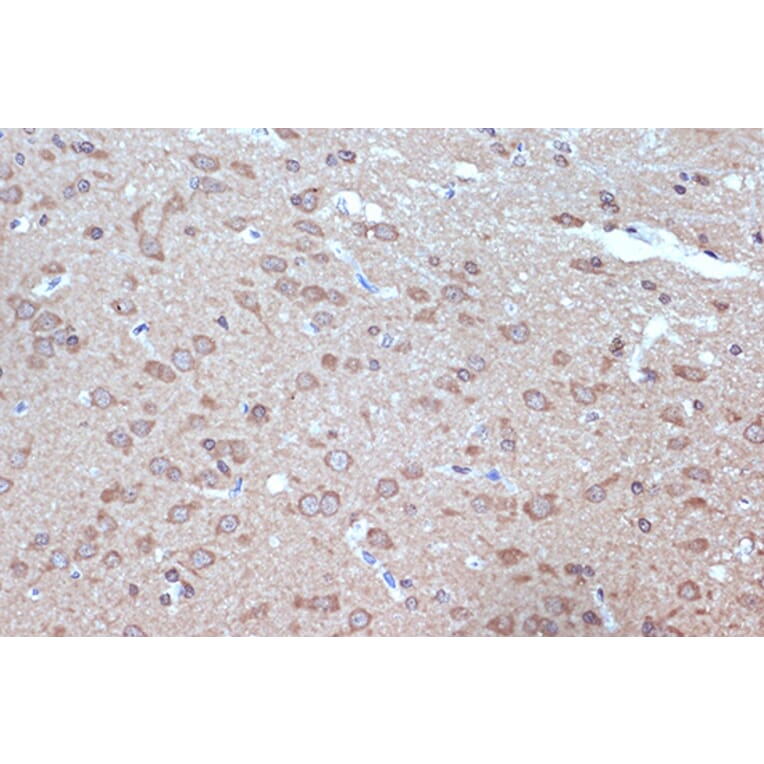 Immunohistochemistry - Anti-BAG2 Antibody [ARC1297] (A306969) - Antibodies.com