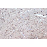Immunohistochemistry - Anti-BAG2 Antibody [ARC1297] (A306969) - Antibodies.com