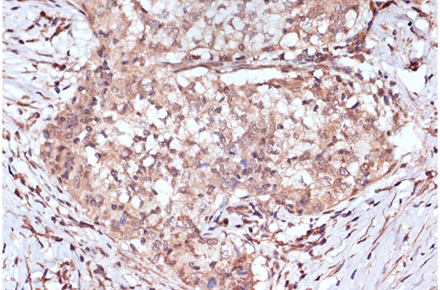 Immunohistochemistry - Anti-BAG2 Antibody [ARC1297] (A306969) - Antibodies.com