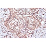 Immunohistochemistry - Anti-BAG2 Antibody [ARC1297] (A306969) - Antibodies.com