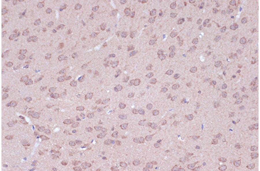 Immunohistochemistry - Anti-BAG2 Antibody [ARC1297] (A306969) - Antibodies.com