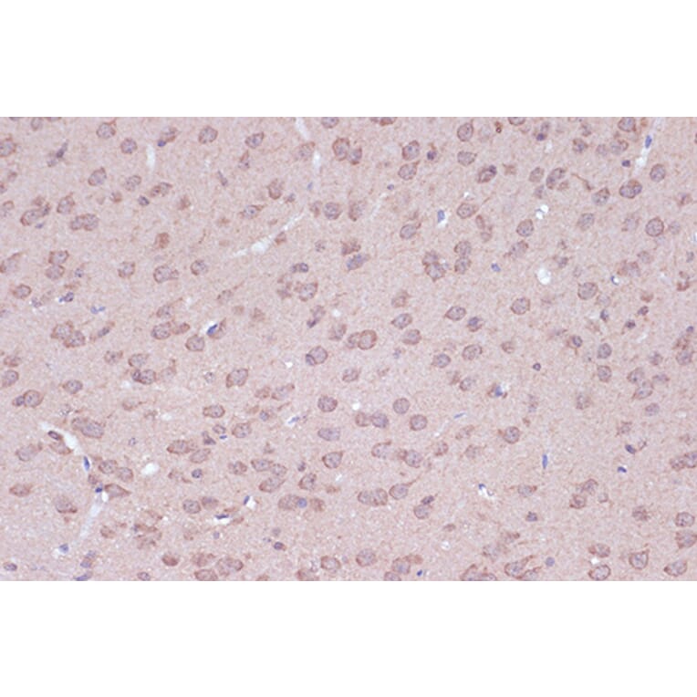 Immunohistochemistry - Anti-BAG2 Antibody [ARC1297] (A306969) - Antibodies.com