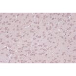 Immunohistochemistry - Anti-BAG2 Antibody [ARC1297] (A306969) - Antibodies.com
