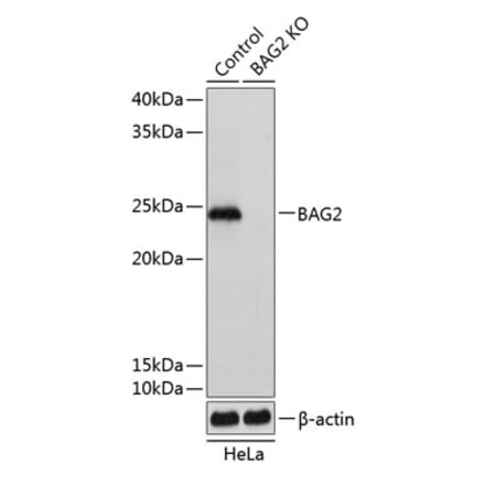 Western Blot - Anti-BAG2 Antibody (A306970) - Antibodies.com