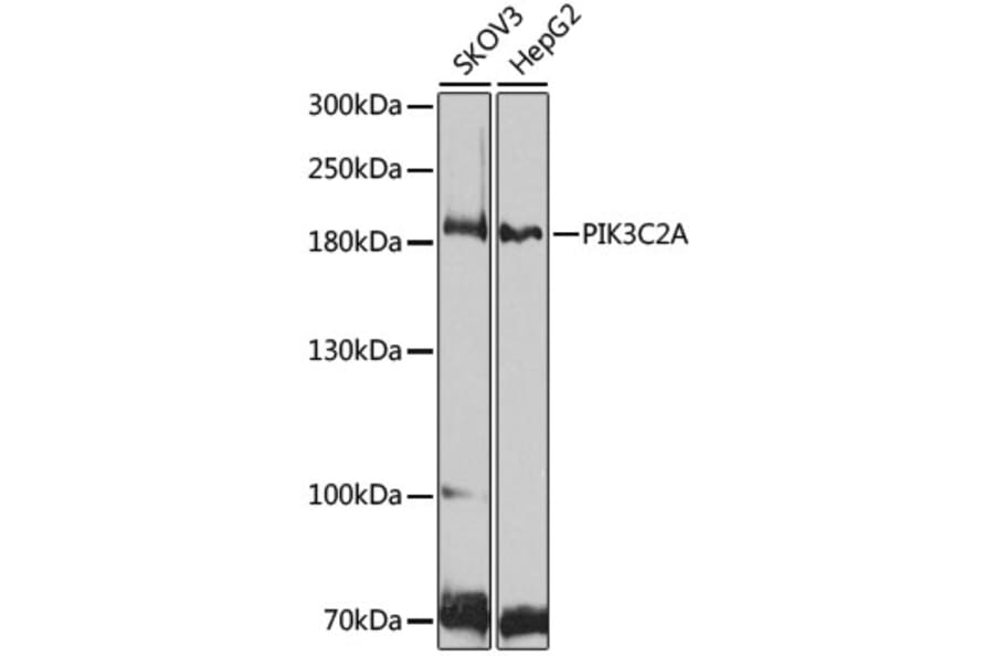 Western Blot - Anti-PI 3 Kinase Class 2A/Cpk Antibody (A306971) - Antibodies.com