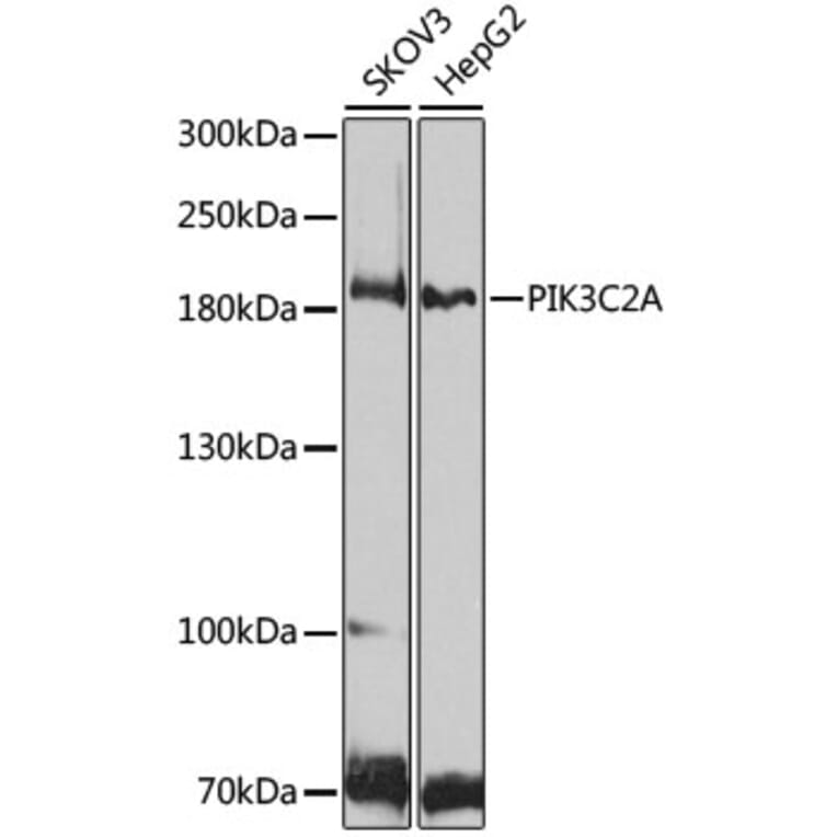 Western Blot - Anti-PI 3 Kinase Class 2A/Cpk Antibody (A306971) - Antibodies.com