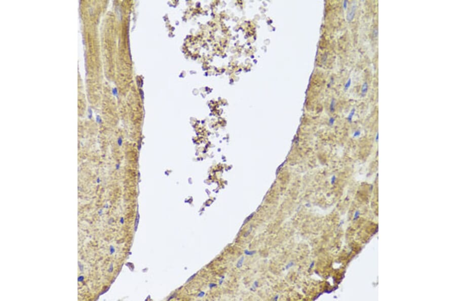 Immunohistochemistry - Anti-PI 3 Kinase Class 2A/Cpk Antibody (A306971) - Antibodies.com