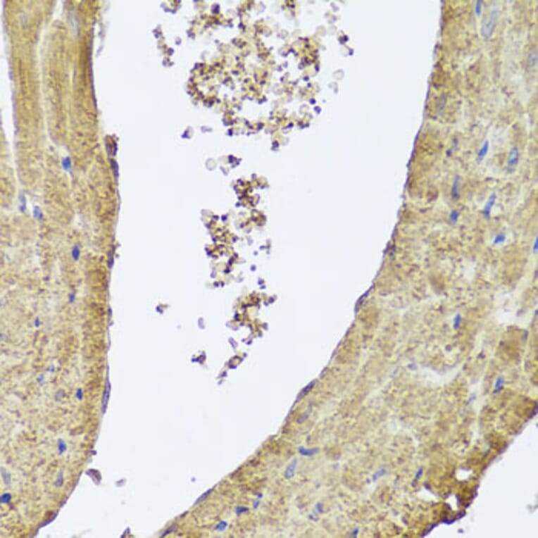 Immunohistochemistry - Anti-PI 3 Kinase Class 2A/Cpk Antibody (A306971) - Antibodies.com