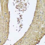 Immunohistochemistry - Anti-PI 3 Kinase Class 2A/Cpk Antibody (A306971) - Antibodies.com