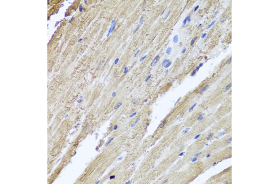 Immunohistochemistry - Anti-PI 3 Kinase Class 2A/Cpk Antibody (A306971) - Antibodies.com