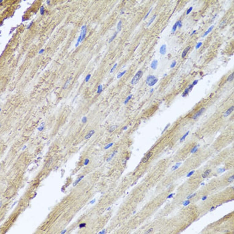 Immunohistochemistry - Anti-PI 3 Kinase Class 2A/Cpk Antibody (A306971) - Antibodies.com