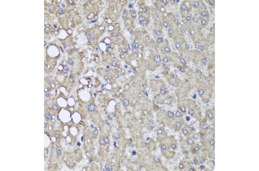 Immunohistochemistry - Anti-PI 3 Kinase Class 2A/Cpk Antibody (A306971) - Antibodies.com
