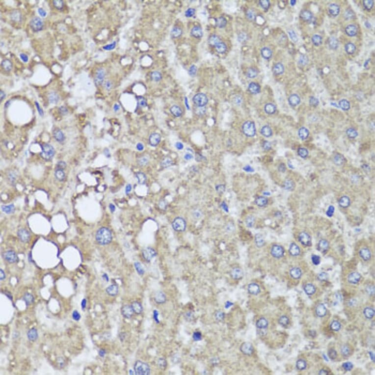Immunohistochemistry - Anti-PI 3 Kinase Class 2A/Cpk Antibody (A306971) - Antibodies.com