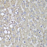 Immunohistochemistry - Anti-PI 3 Kinase Class 2A/Cpk Antibody (A306971) - Antibodies.com