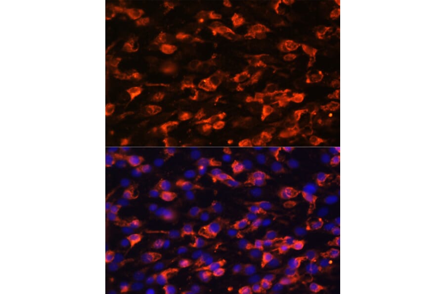 Immunofluorescence - Anti-PI 3 Kinase Class 2A/Cpk Antibody (A306971) - Antibodies.com