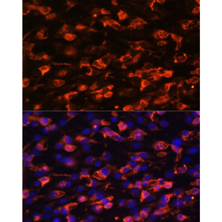Immunofluorescence - Anti-PI 3 Kinase Class 2A/Cpk Antibody (A306971) - Antibodies.com