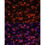 Immunofluorescence - Anti-PI 3 Kinase Class 2A/Cpk Antibody (A306971) - Antibodies.com