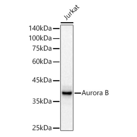 Western Blot - Anti-Aurora B Antibody [ARC50892] (A306973) - Antibodies.com