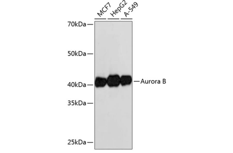 Western Blot - Anti-Aurora B Antibody [ARC50905] (A306974) - Antibodies.com