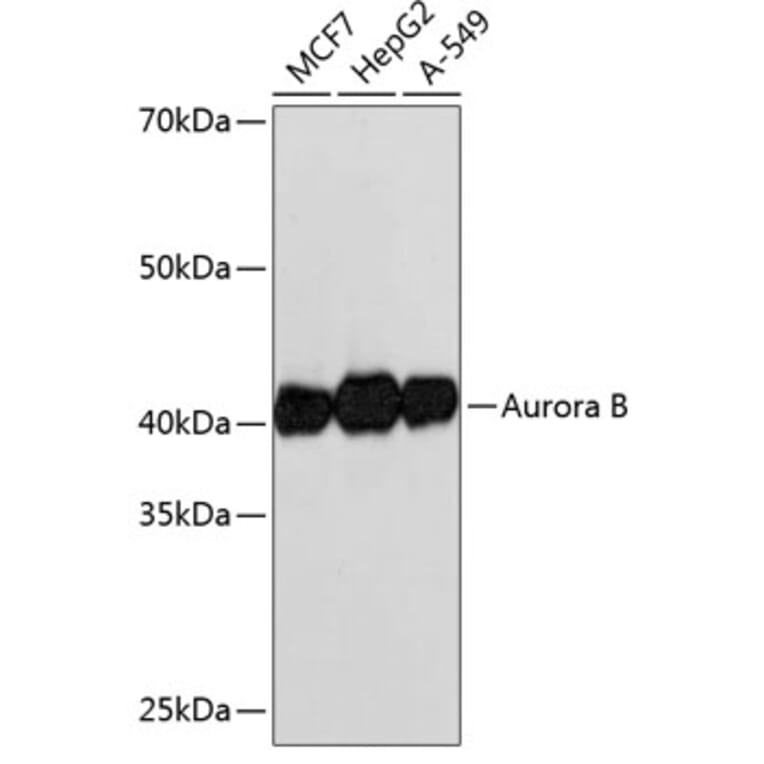 Western Blot - Anti-Aurora B Antibody [ARC50905] (A306974) - Antibodies.com