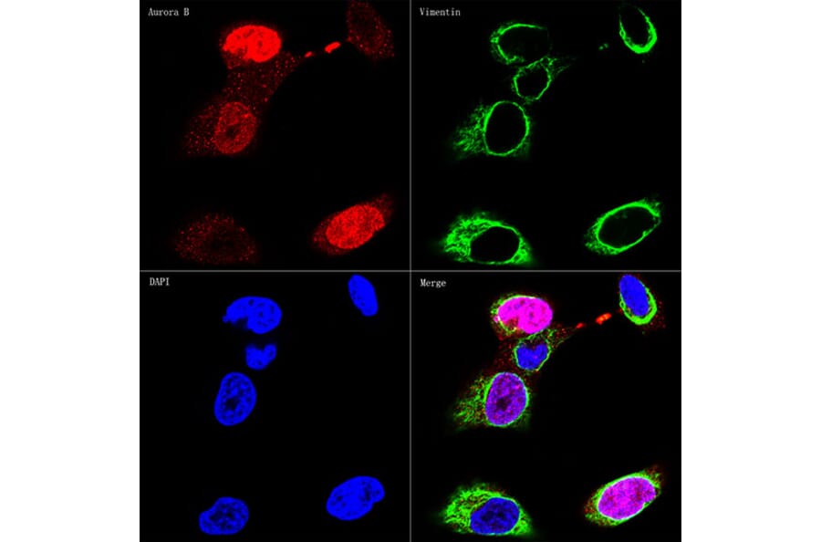 Immunofluorescence - Anti-Aurora B Antibody [ARC50905] (A306974) - Antibodies.com