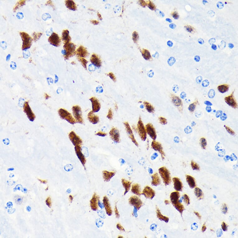 Immunohistochemistry - Anti-NeuN Antibody [ARC0202] (A306978) - Antibodies.com