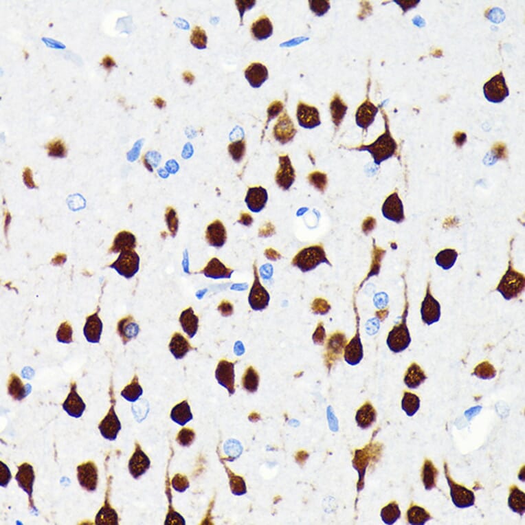 Immunohistochemistry - Anti-NeuN Antibody [ARC0202] (A306978) - Antibodies.com