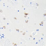 Immunohistochemistry - Anti-NeuN Antibody [ARC0202] (A306978) - Antibodies.com