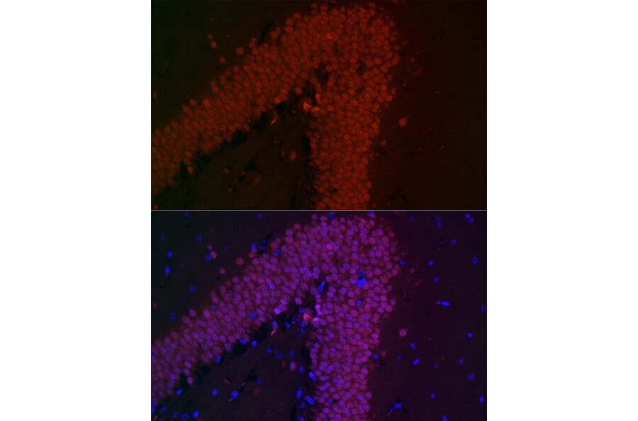 Immunofluorescence - Anti-NeuN Antibody [ARC0202] (A306978) - Antibodies.com