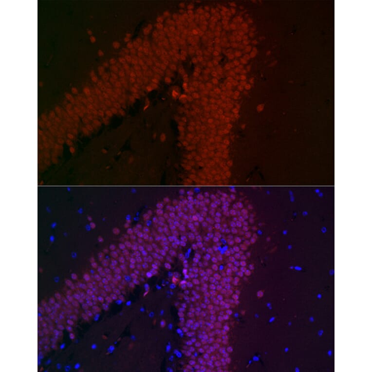 Immunofluorescence - Anti-NeuN Antibody [ARC0202] (A306978) - Antibodies.com