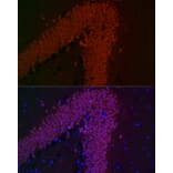 Immunofluorescence - Anti-NeuN Antibody [ARC0202] (A306978) - Antibodies.com