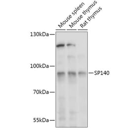 Western Blot - Anti-SP140 Antibody (A306979) - Antibodies.com