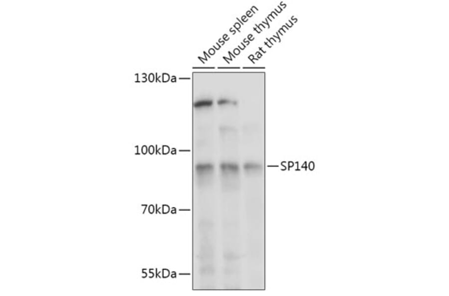 Western Blot - Anti-SP140 Antibody (A306979) - Antibodies.com