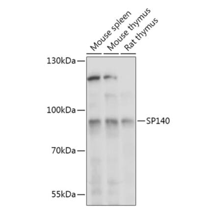 Western Blot - Anti-SP140 Antibody (A306979) - Antibodies.com