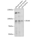 Western Blot - Anti-SP140 Antibody (A306979) - Antibodies.com