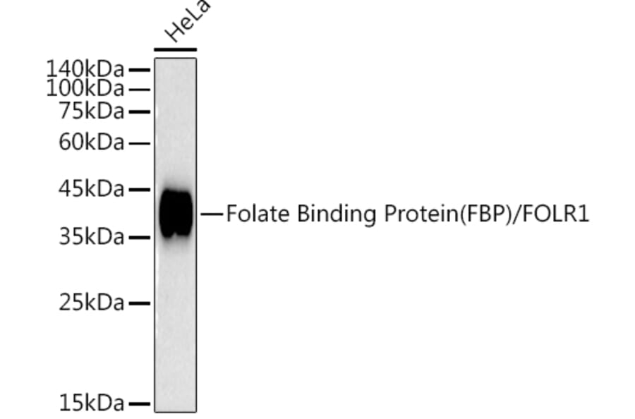 Western Blot - Anti-Folate Binding Protein/FBP Antibody [ARC50859] (A306981) - Antibodies.com