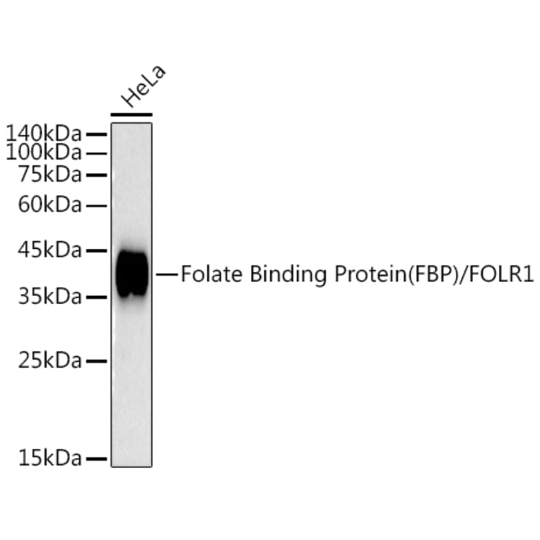 Western Blot - Anti-Folate Binding Protein/FBP Antibody [ARC50859] (A306981) - Antibodies.com