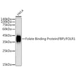 Western Blot - Anti-Folate Binding Protein/FBP Antibody [ARC50859] (A306981) - Antibodies.com