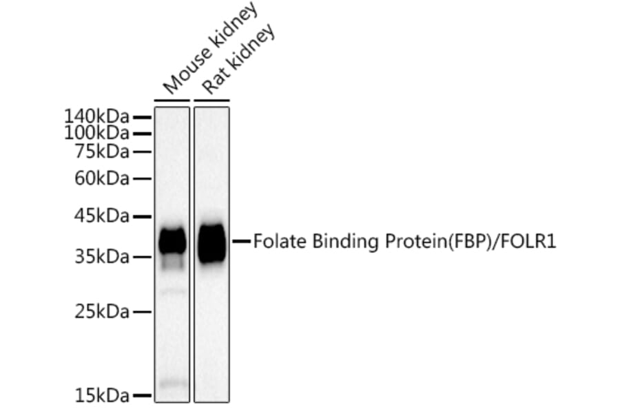 Western Blot - Anti-Folate Binding Protein/FBP Antibody [ARC50859] (A306981) - Antibodies.com