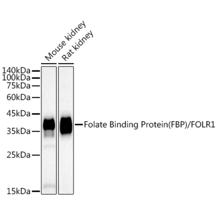 Western Blot - Anti-Folate Binding Protein/FBP Antibody [ARC50859] (A306981) - Antibodies.com