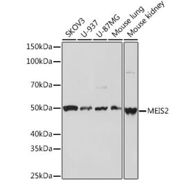 Western Blot - Anti-MEIS2 Antibody [ARC2049] (A306983) - Antibodies.com